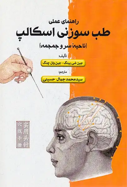 راهنمای عملی طب سوزنی اسکالپ(ناحیه سر و جمجمه)