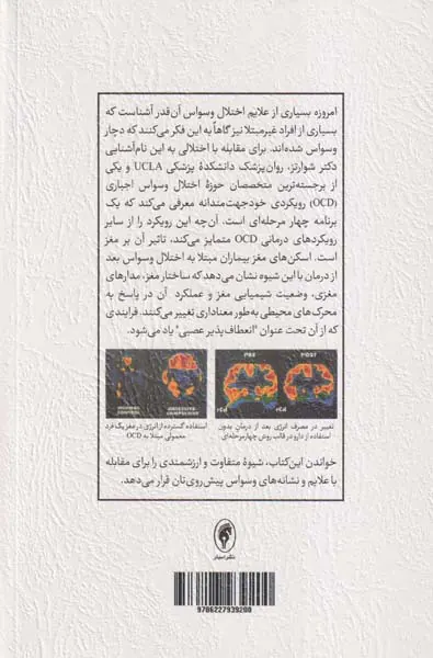 قفل گشایی از مغز وسواسی